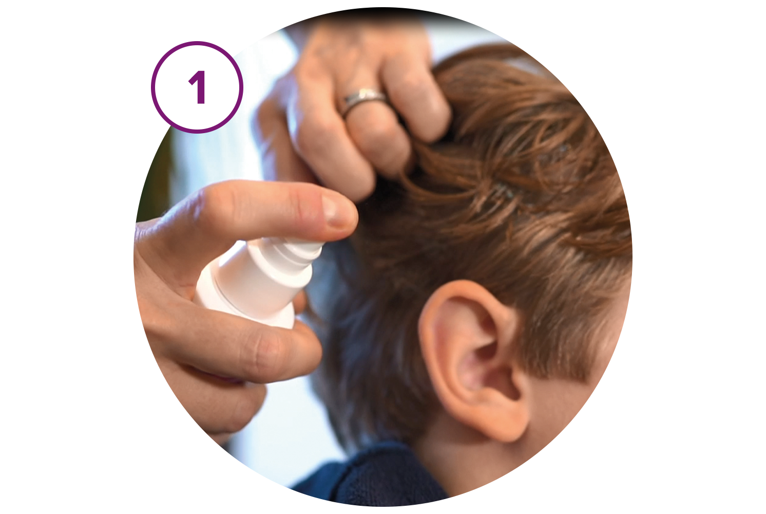 Paranix Express Spray Tratamento Piolhos 95ml