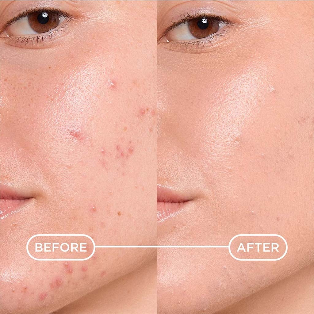 Bioderma Sebium Kerato+ Gel Creme SPF30 30ml