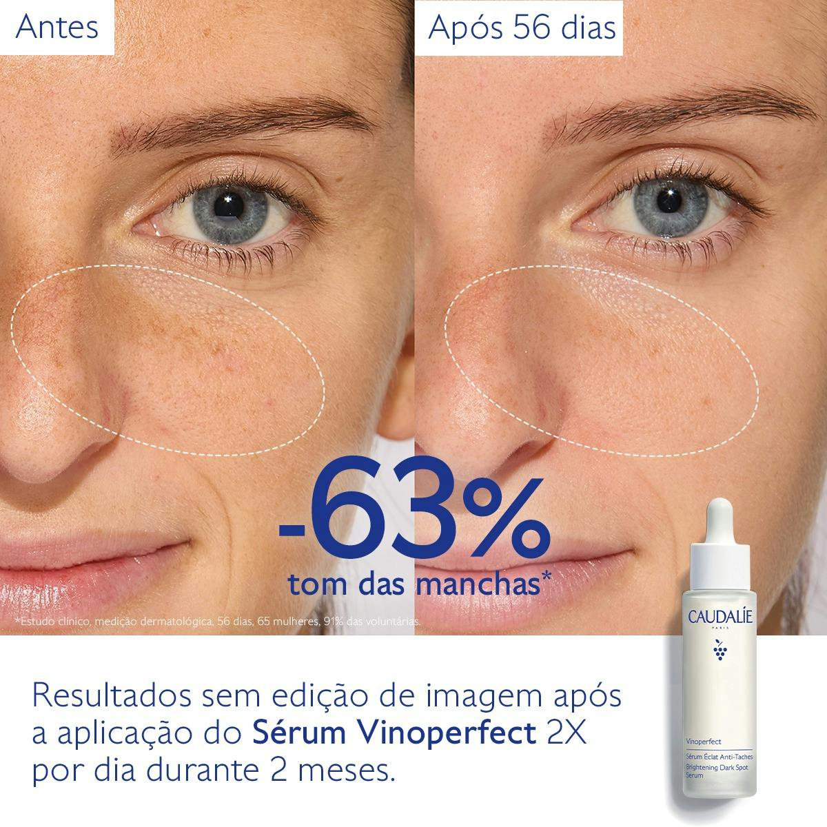 Vinoperfect Sérum Luminosidade Antimanchas 50ml - Farmácia Garcia