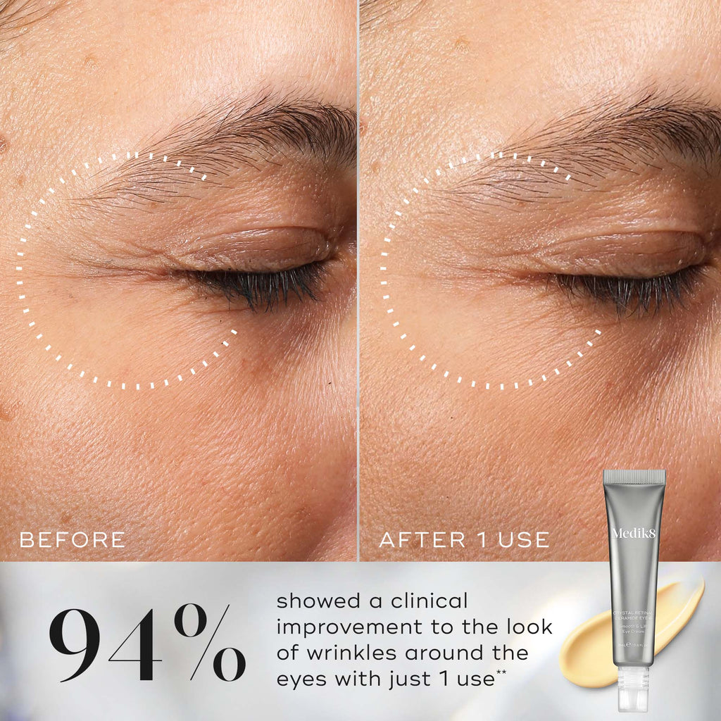 Medik8 Crystal Retinal Ceramida Eye 10 Creme 15ml - Farmácia Garcia