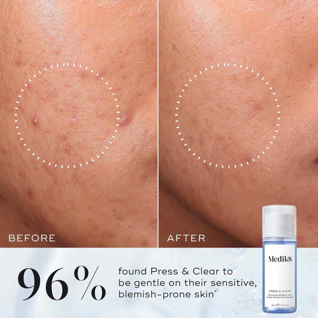 Medik8 Press&Clear Tónico Esfoliante 30ml - Farmácia Garcia