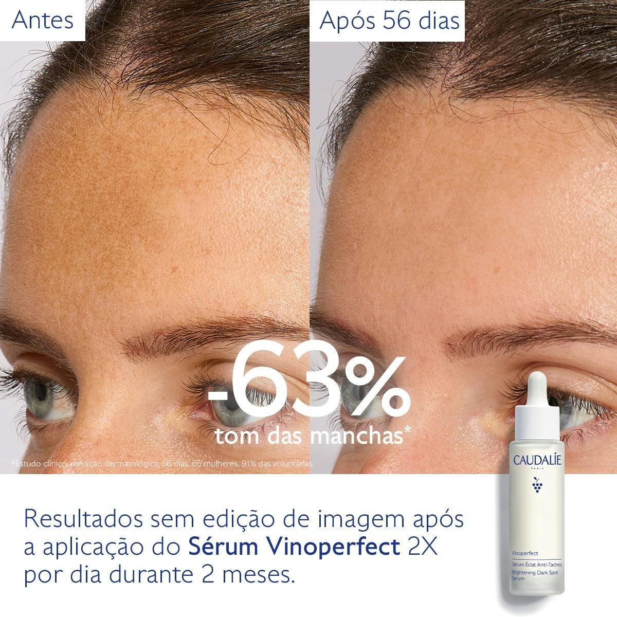 Vinoperfect Sérum Luminosidade Antimanchas 50ml - Farmácia Garcia