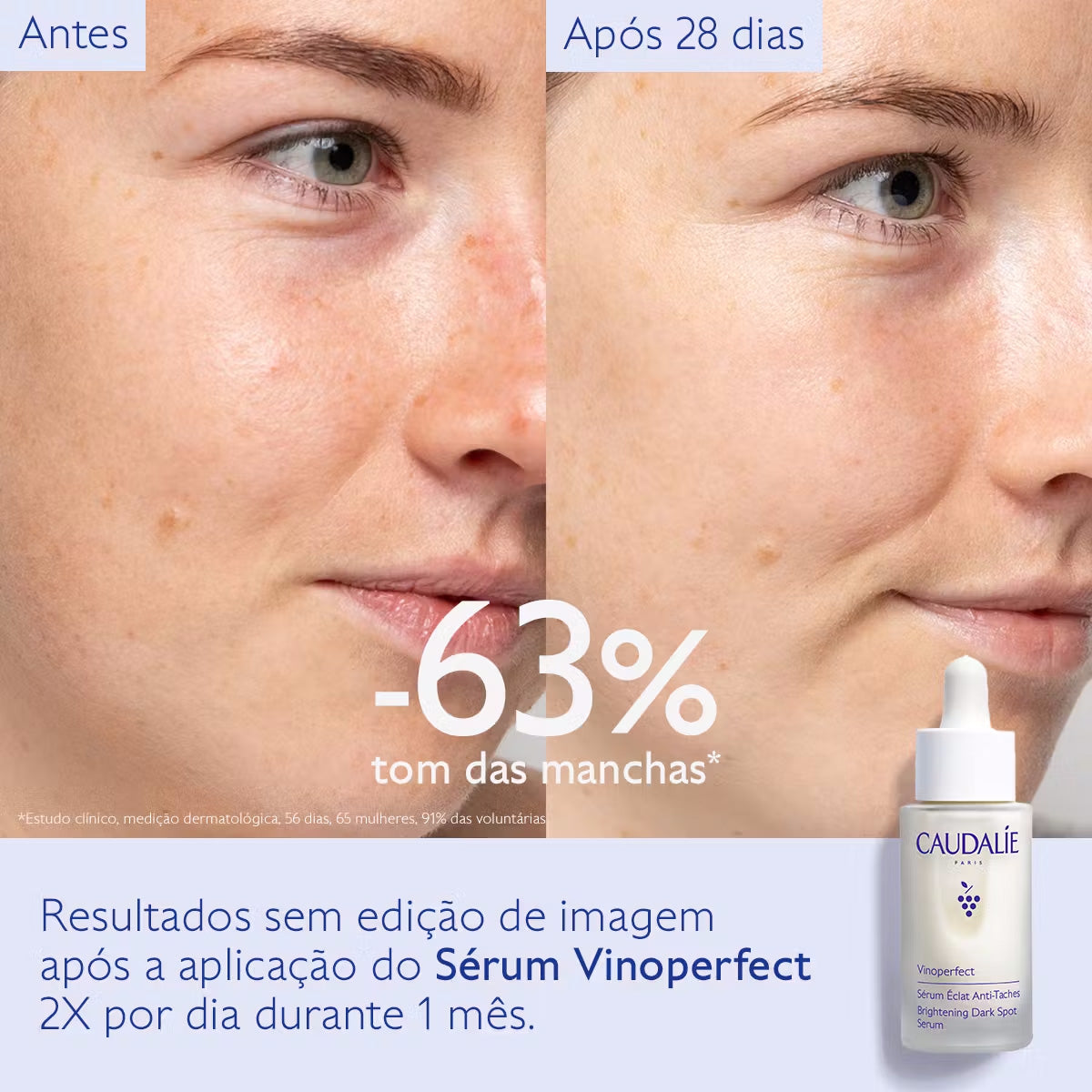Vinoperfect Sérum Luminosidade Antimanchas 30ml - Farmácia Garcia