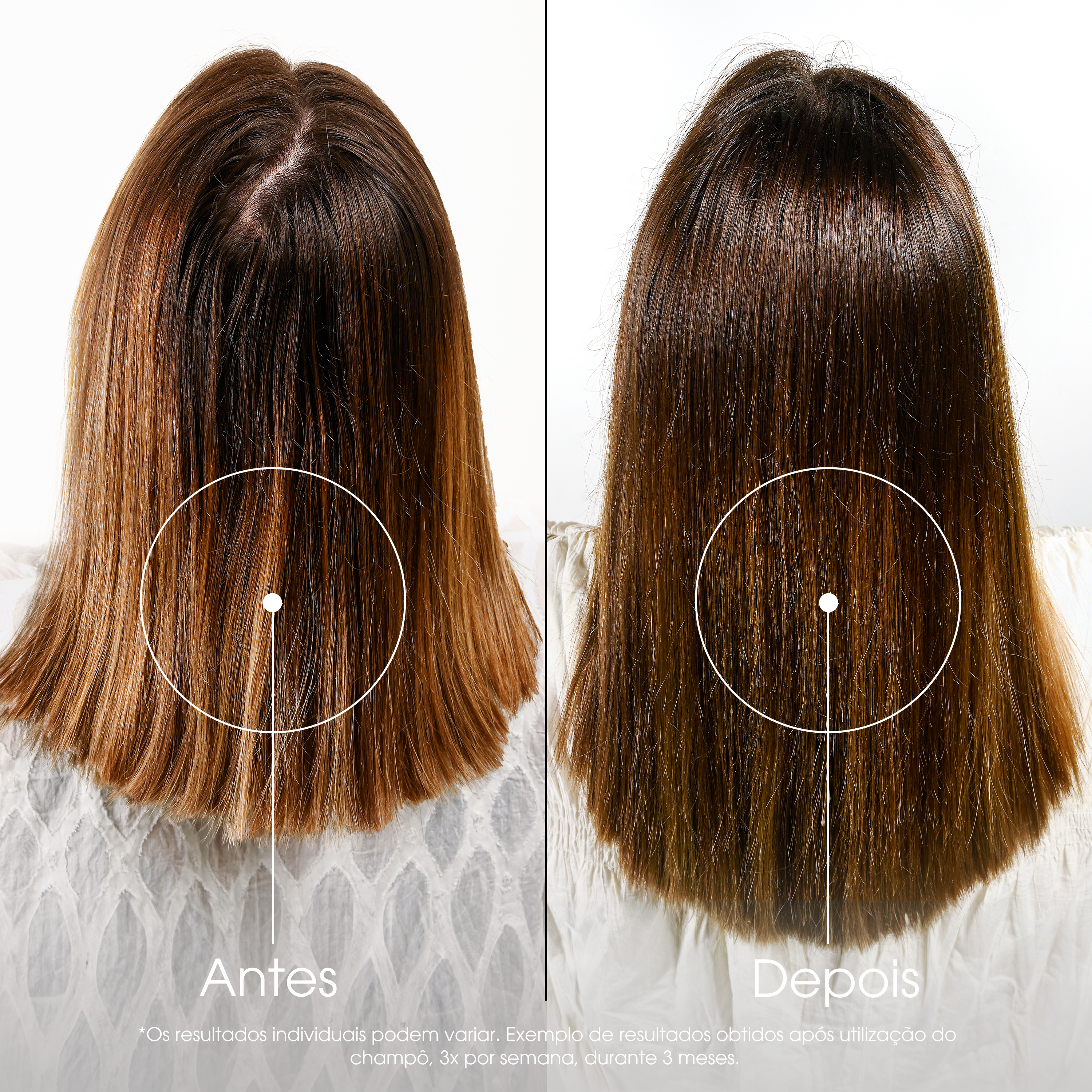 Klorane Capilar Champô Quinina & Edelvaisse BIO 400ml - Farmácia Garcia