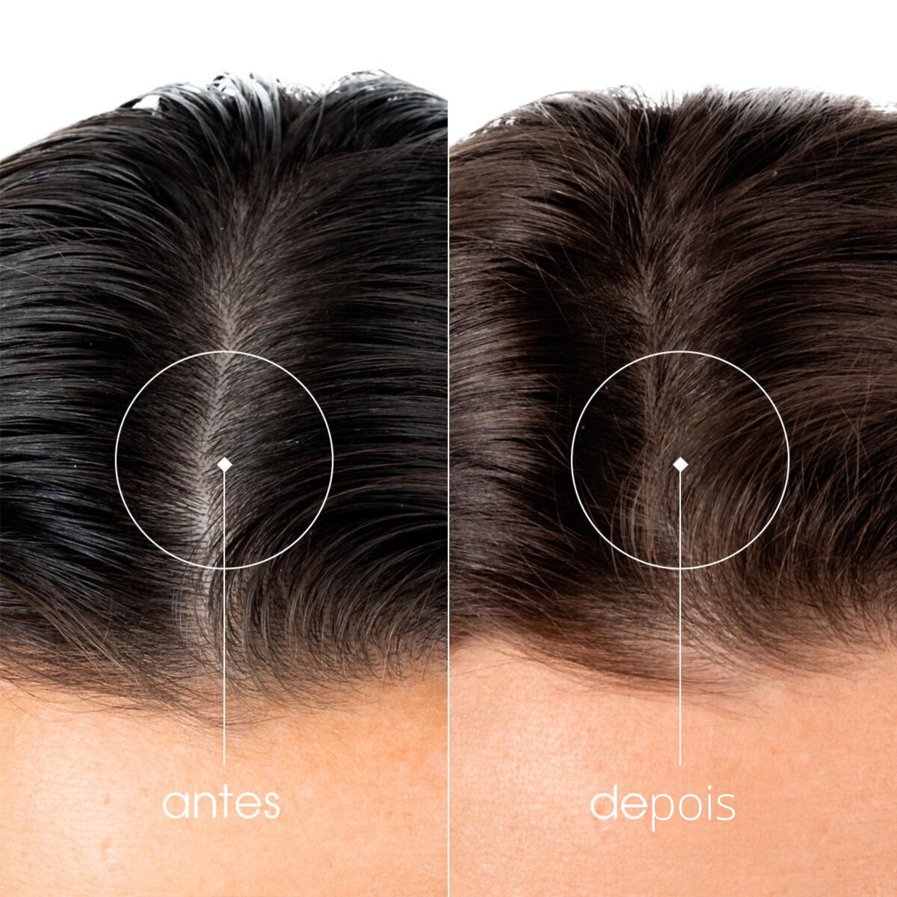 Klorane Capilar Keratincaps 90 Cápsulas - Farmácia Garcia