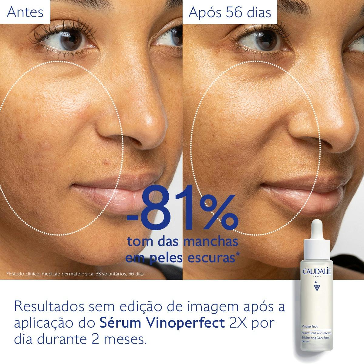 Vinoperfect Sérum Luminosidade Antimanchas 50ml - Farmácia Garcia