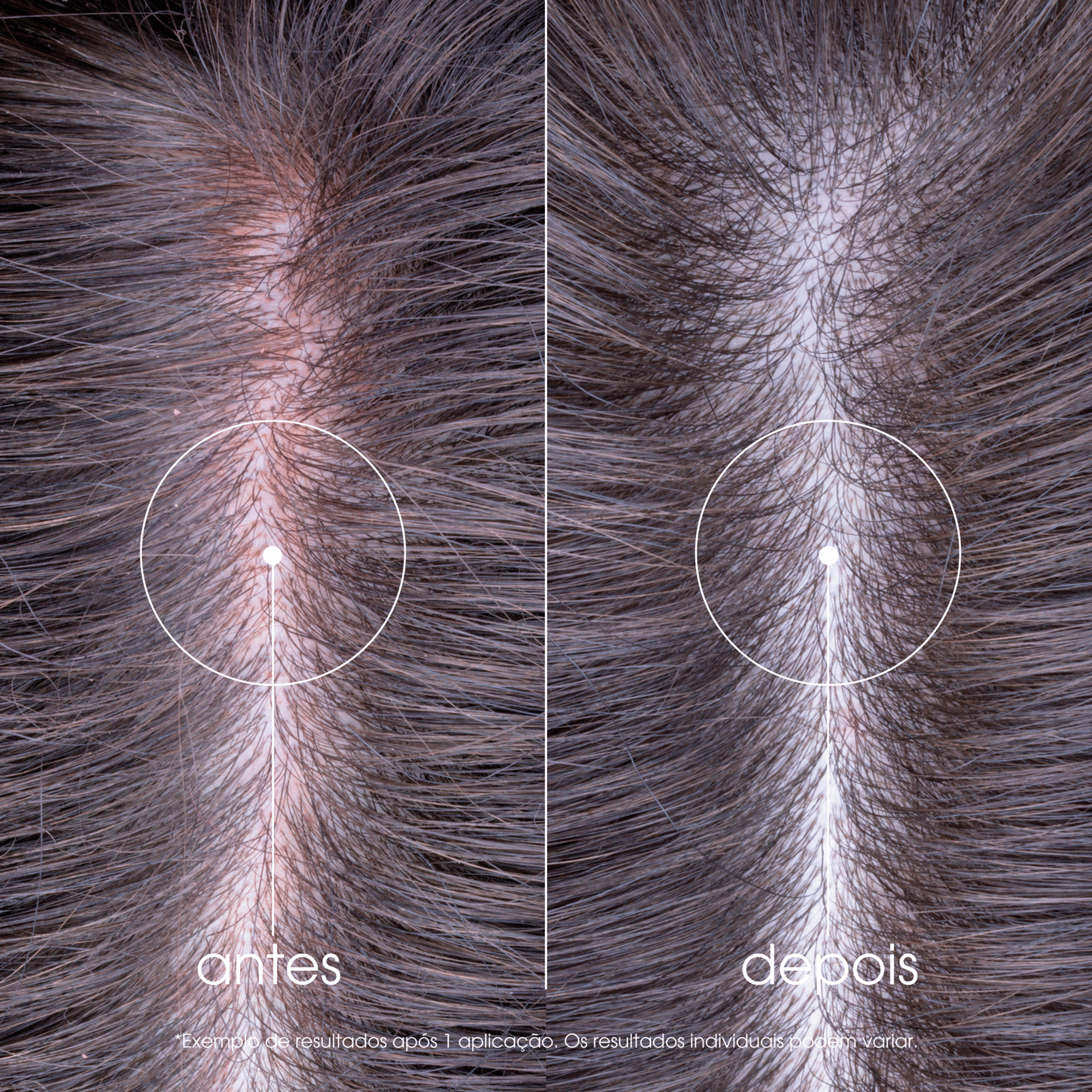 Klorane Capilar Champô Peónia 400ml - Farmácia Garcia