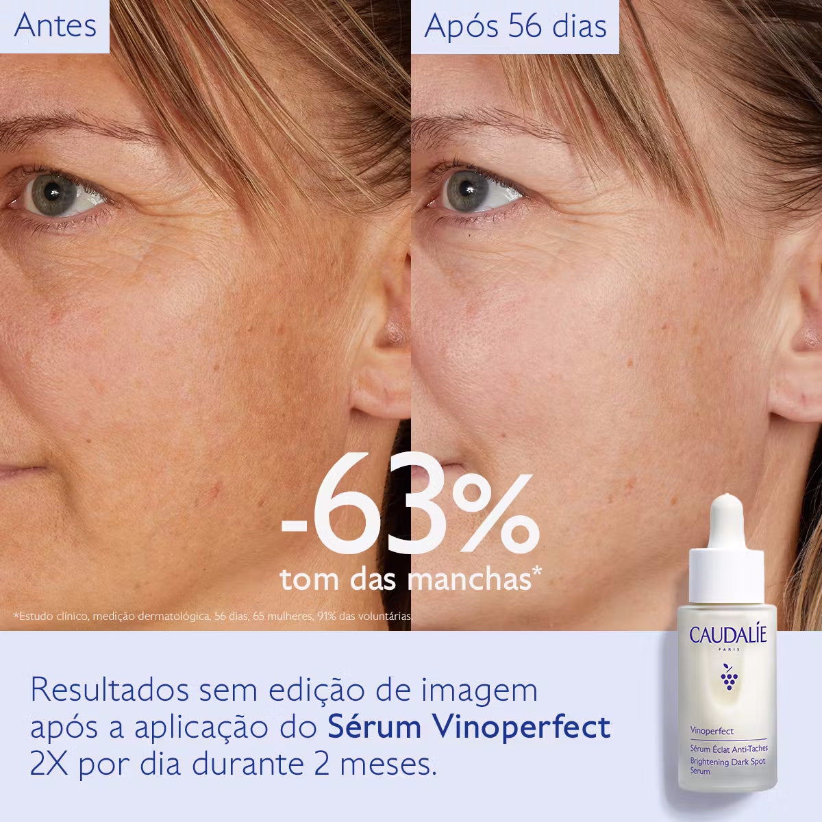 Vinoperfect Sérum Luminosidade Antimanchas 30ml - Farmácia Garcia