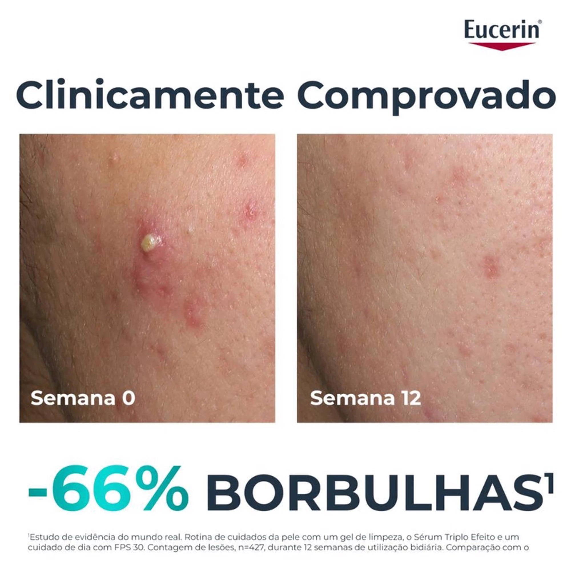 Eucerin Dermopure Sérum Tripla Ação 40ml - Farmácia Garcia