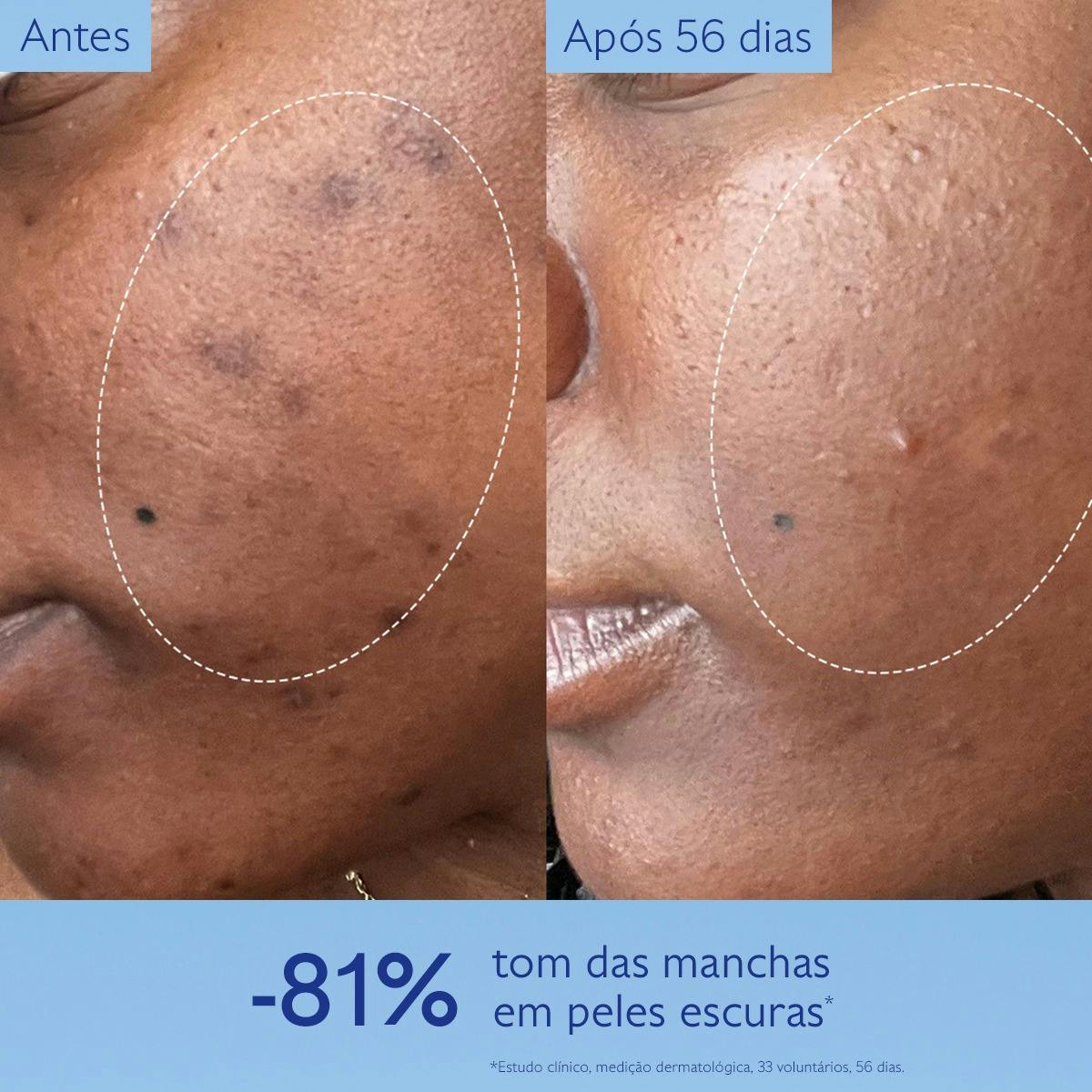Caudalie Vinoperfect Sérum 30ml + Espuma Micro-Peel 50ml Oferta