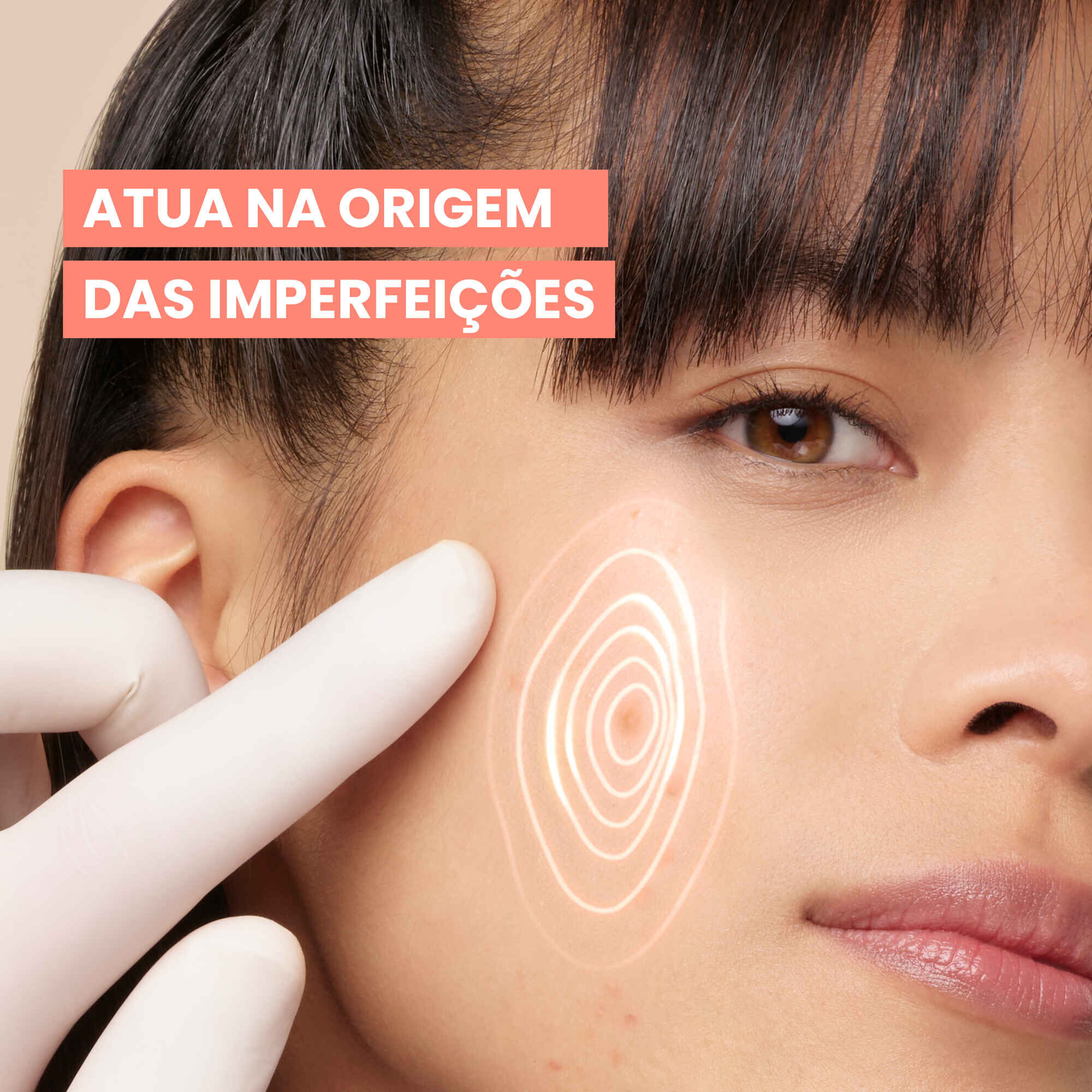 Avene Cleanance Comed+ Cuidado Intensivo 30ml