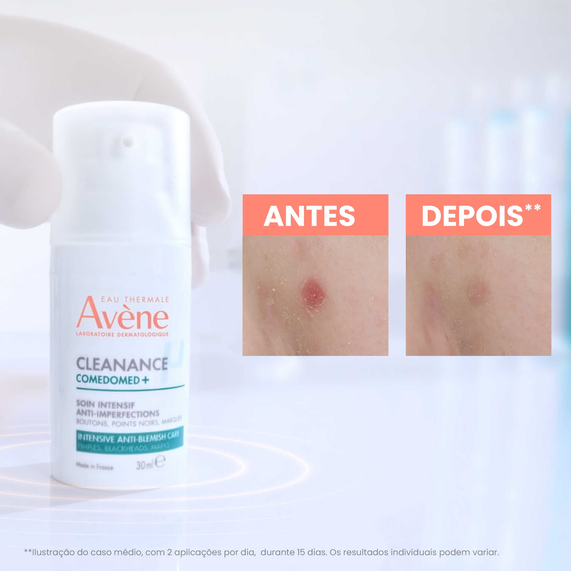 Avene Cleanance Comed+ Cuidado Intensivo 30ml