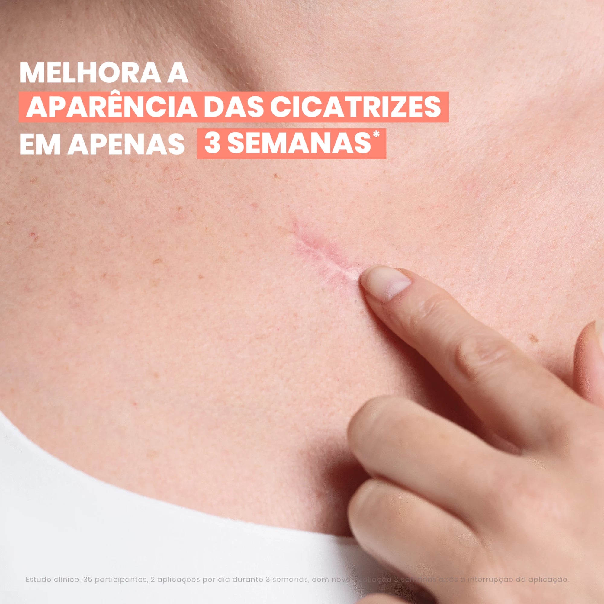Avène Cicalfate+ Gel Remodelante Cicatrizes 40ml - Farmácia Garcia
