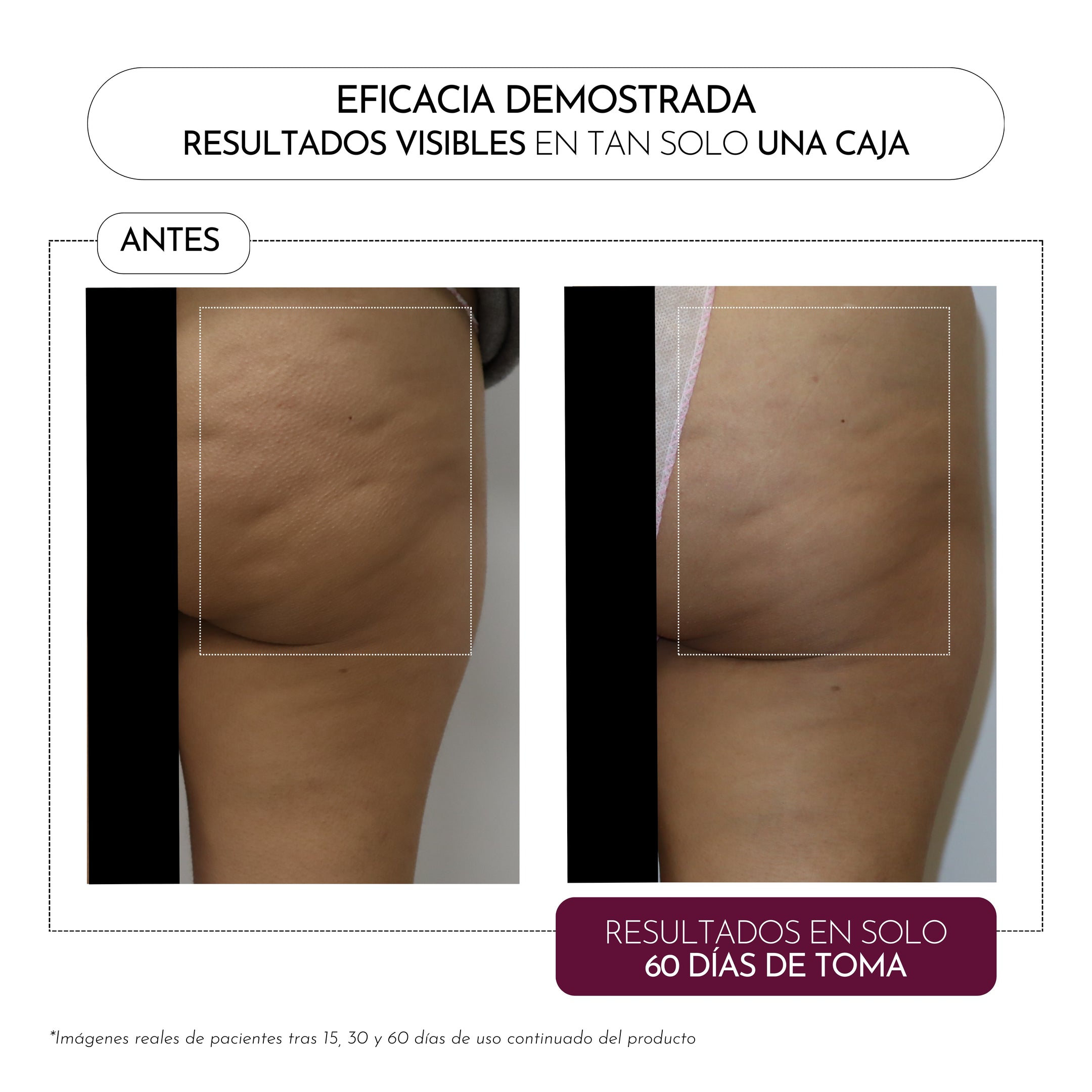 Luxmetique Fórmula Celulox 15 Âmpolas 30ml - Farmácia Garcia