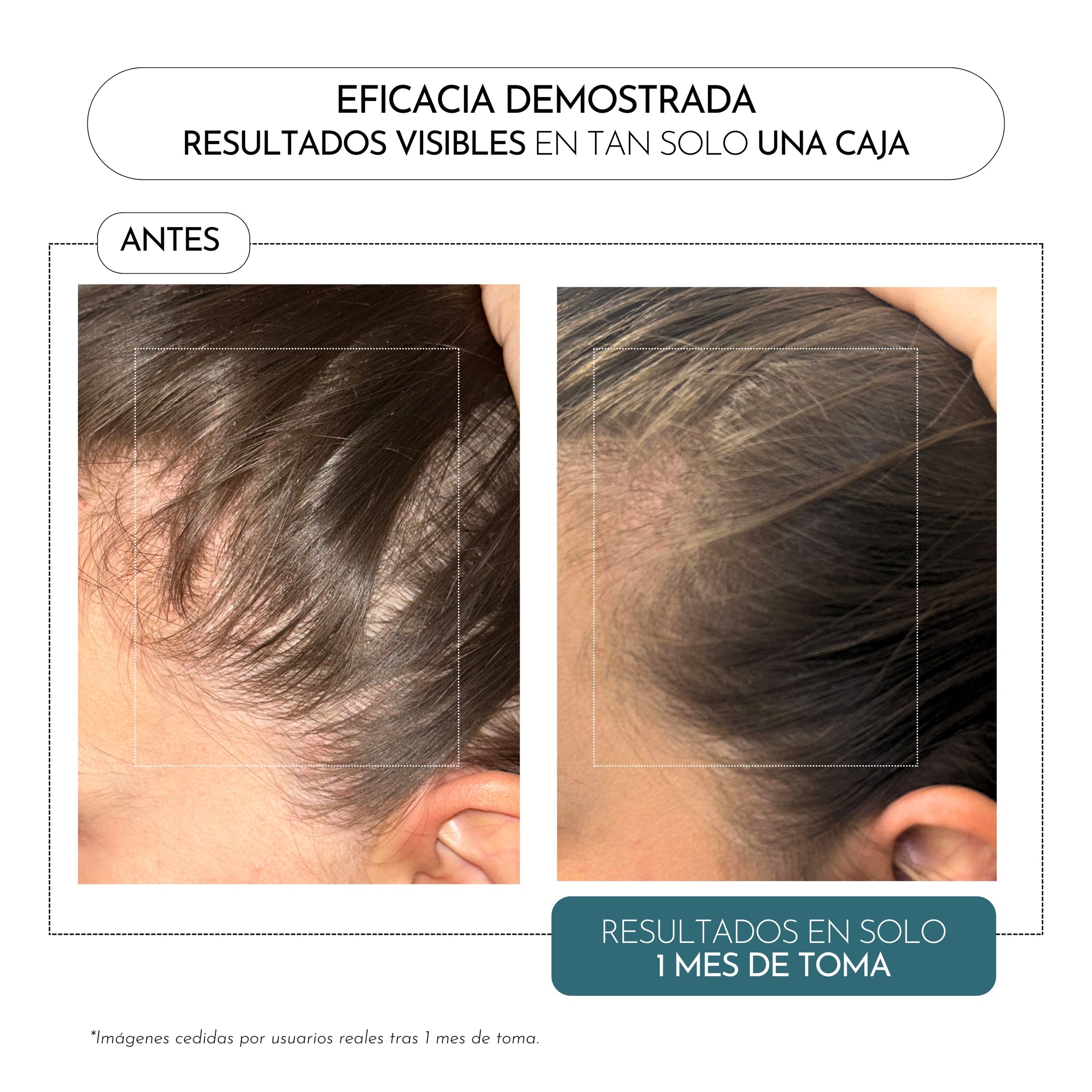 Luxmetique Fórmula Capilar 60 Cápsulas - Farmácia Garcia