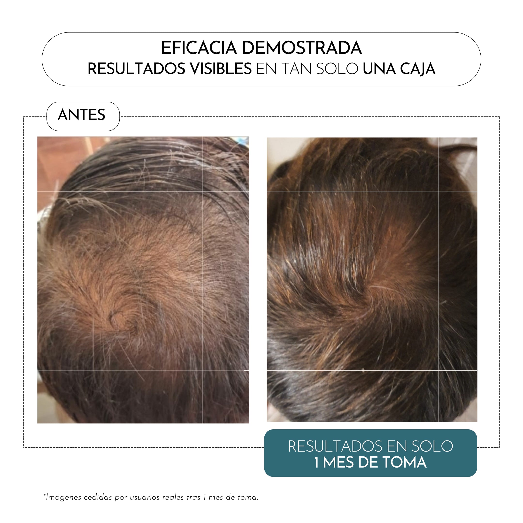 Luxmetique Fórmula Capilar 60 Cápsulas - Farmácia Garcia
