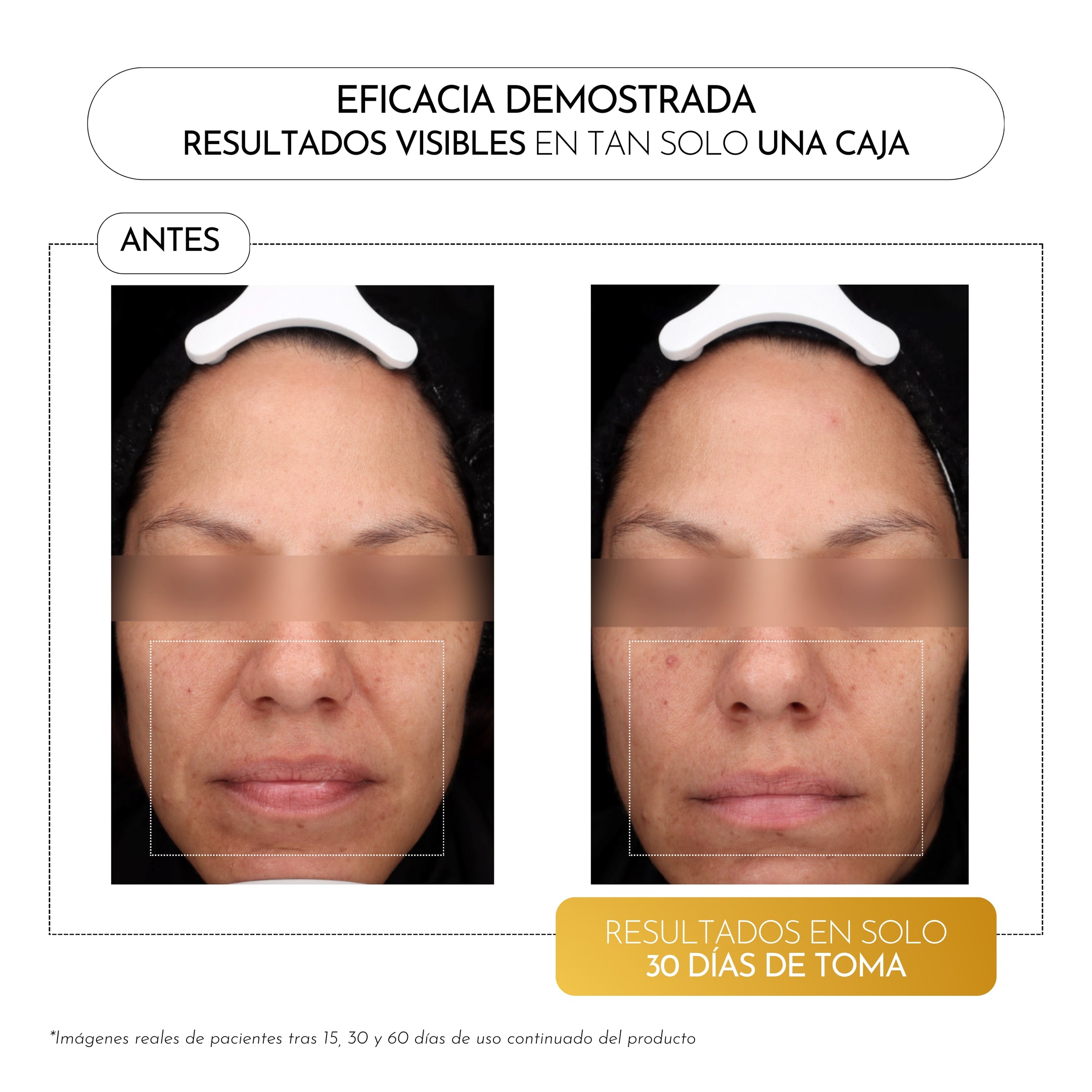 Luxmetique Fórmula Hyagold 15 Âmpolas 30ml - Farmácia Garcia