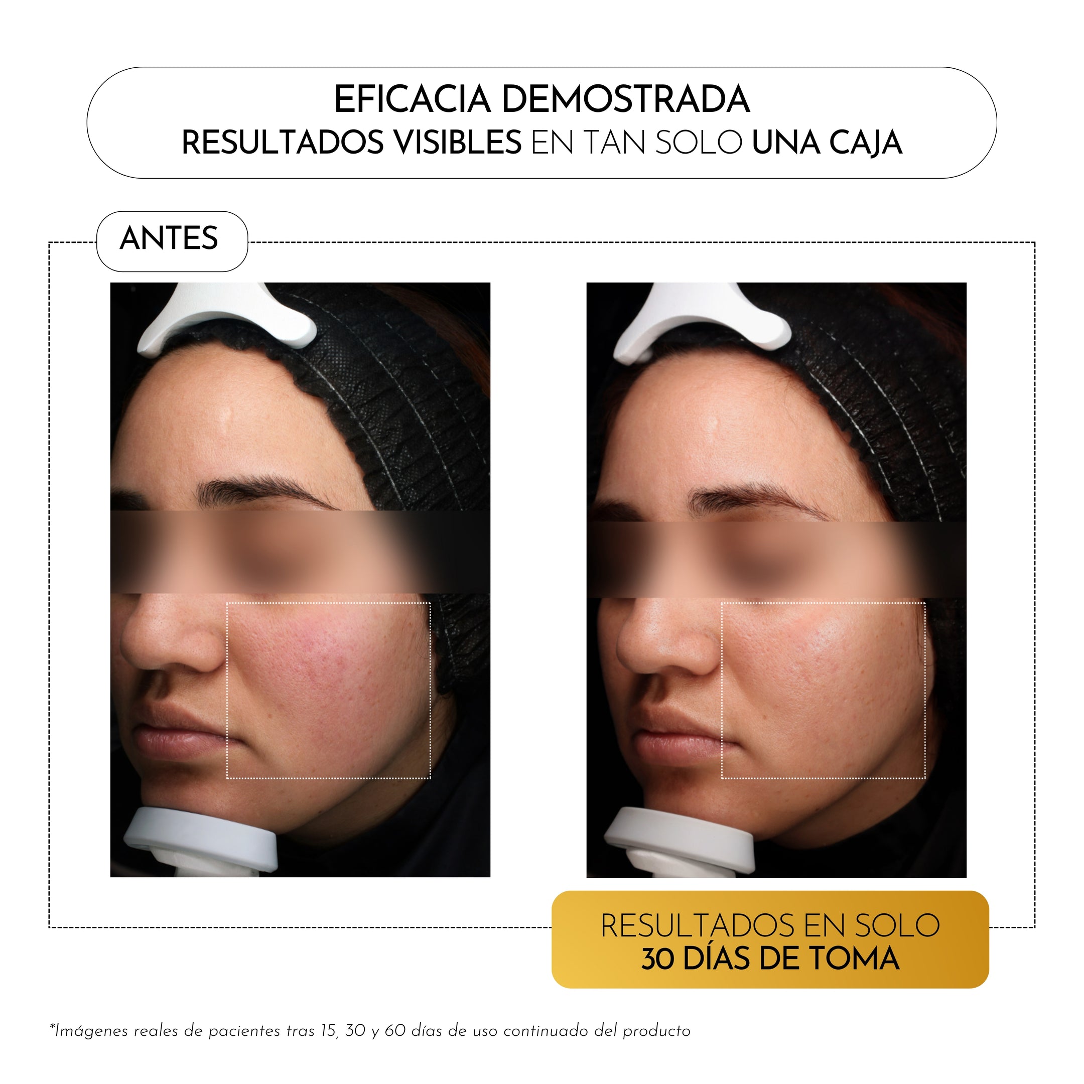 Luxmetique Fórmula Hyagold Noite 15 Âmpolas 30ml - Farmácia Garcia