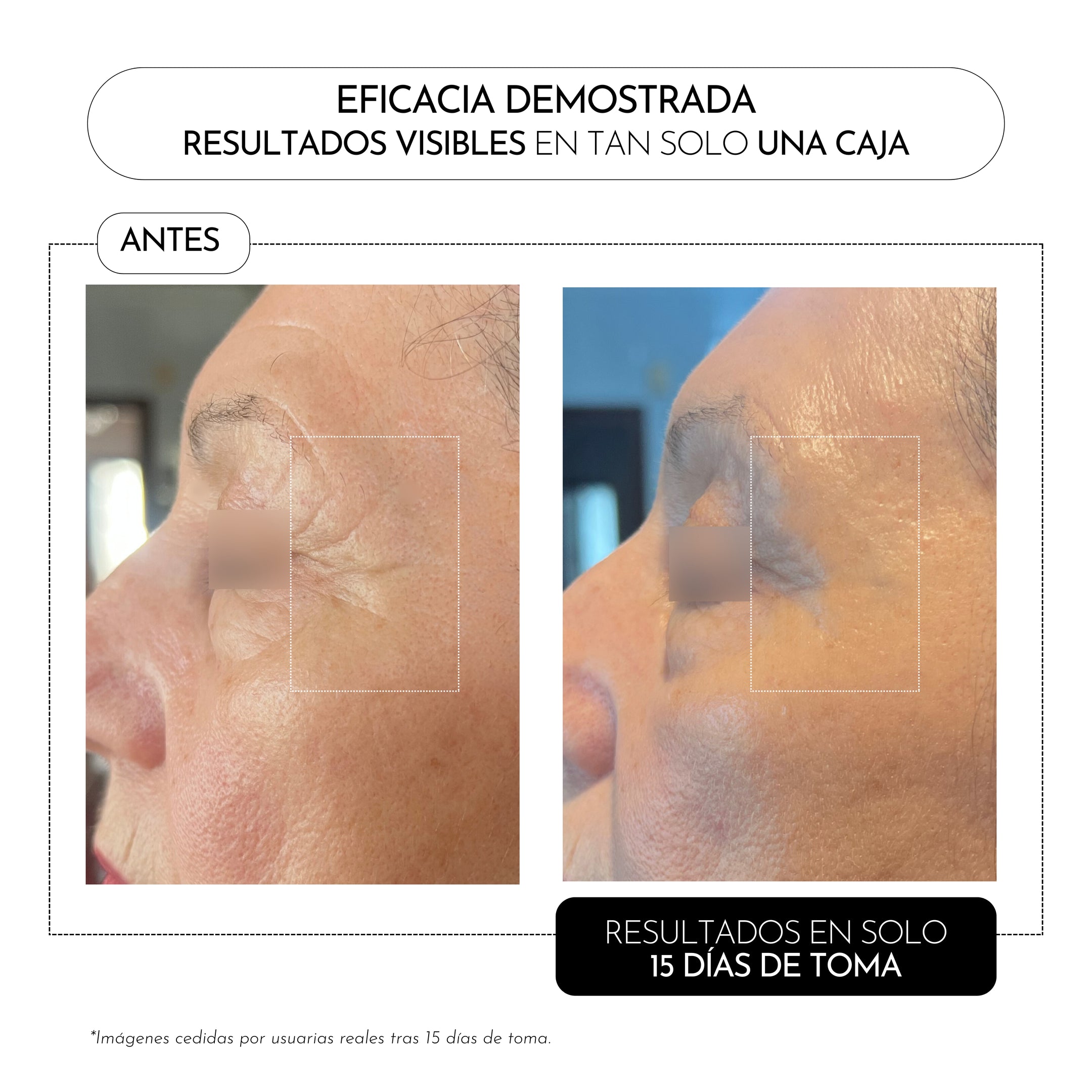 Luxmetique Fórmula Proage 30ml 15 Âmpolas - Farmácia Garcia