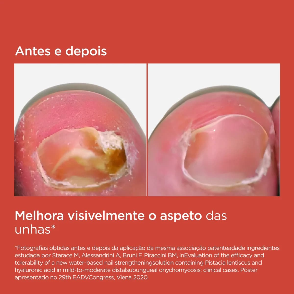 Isdin Si-Nails Micoxpert 4,5ml - Farmácia Garcia