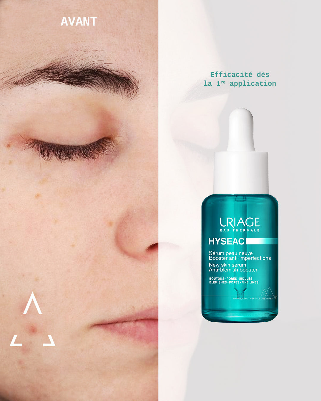 Uriage Hyséac Serúm Boost Anti-Imperfeições 30ml - Farmácia Garcia