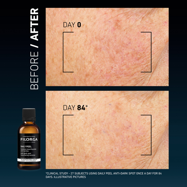 Filorga Daily Peel Antimanchas 50ml - Farmácia Garcia