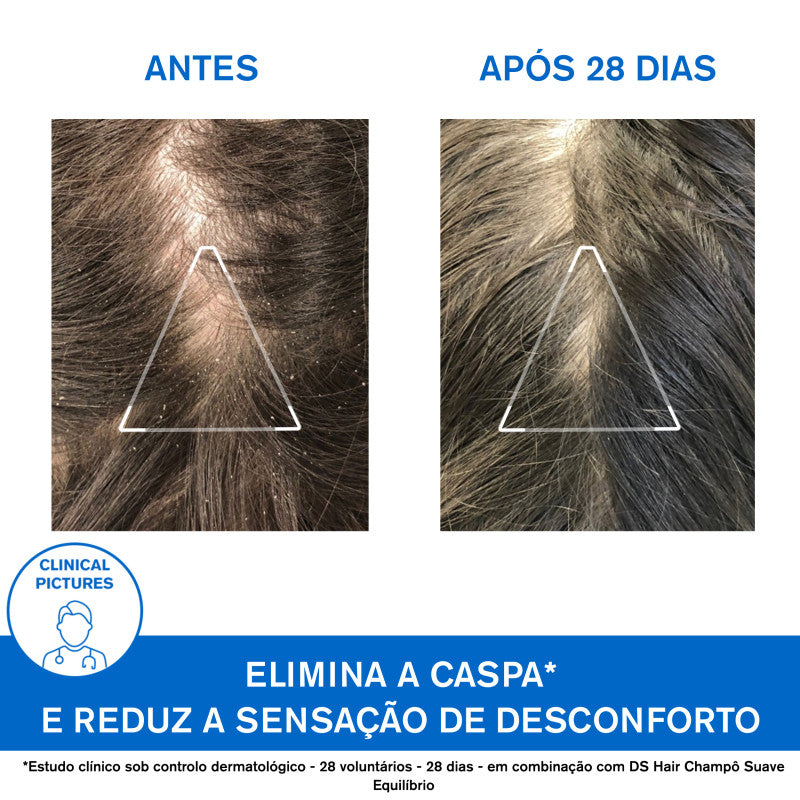 Uriage DS Hair Champô Caspa 500ml - Farmácia Garcia
