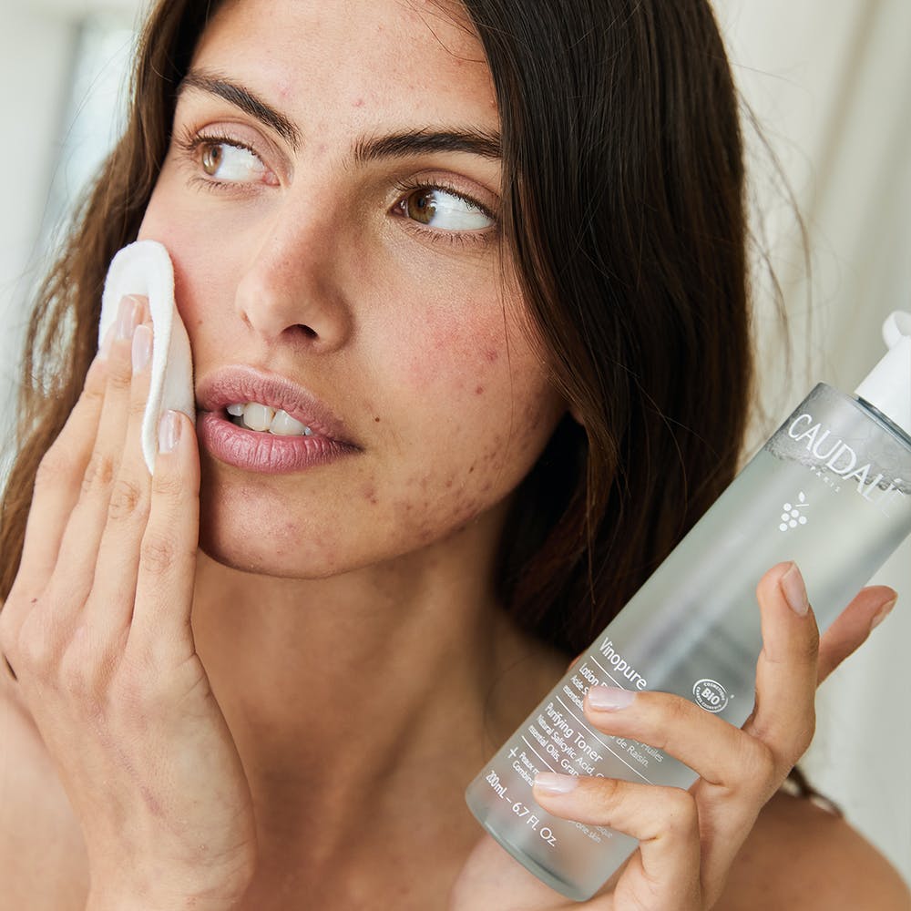 Vinopure Loção Purificante 200ml - Farmácia Garcia